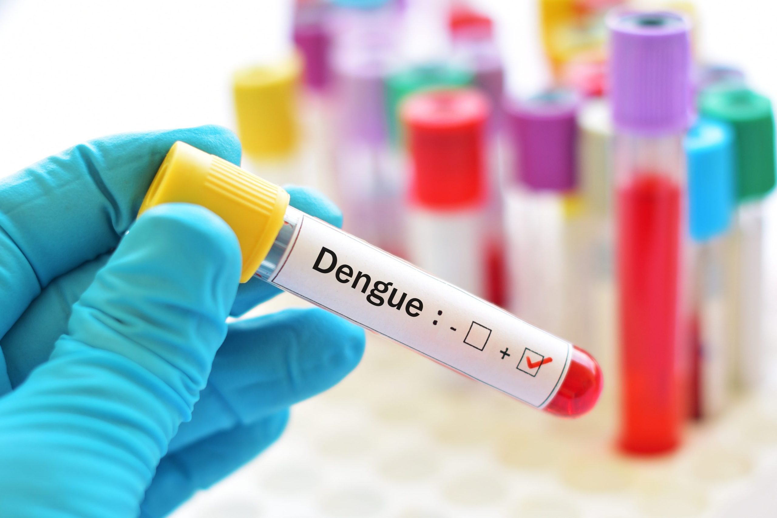 dengue cos'è sintomi come si trasmette