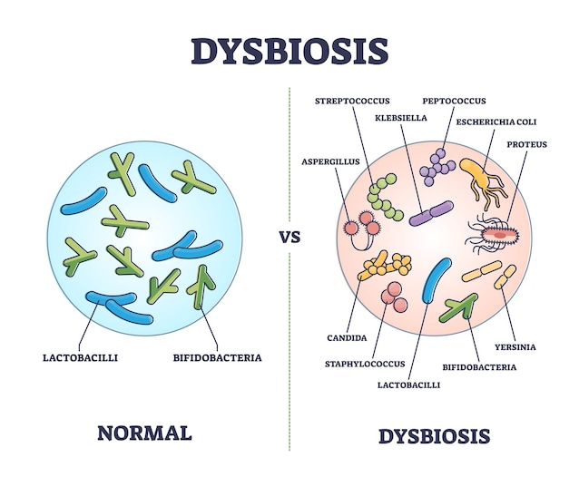Dysbiose du microbiote