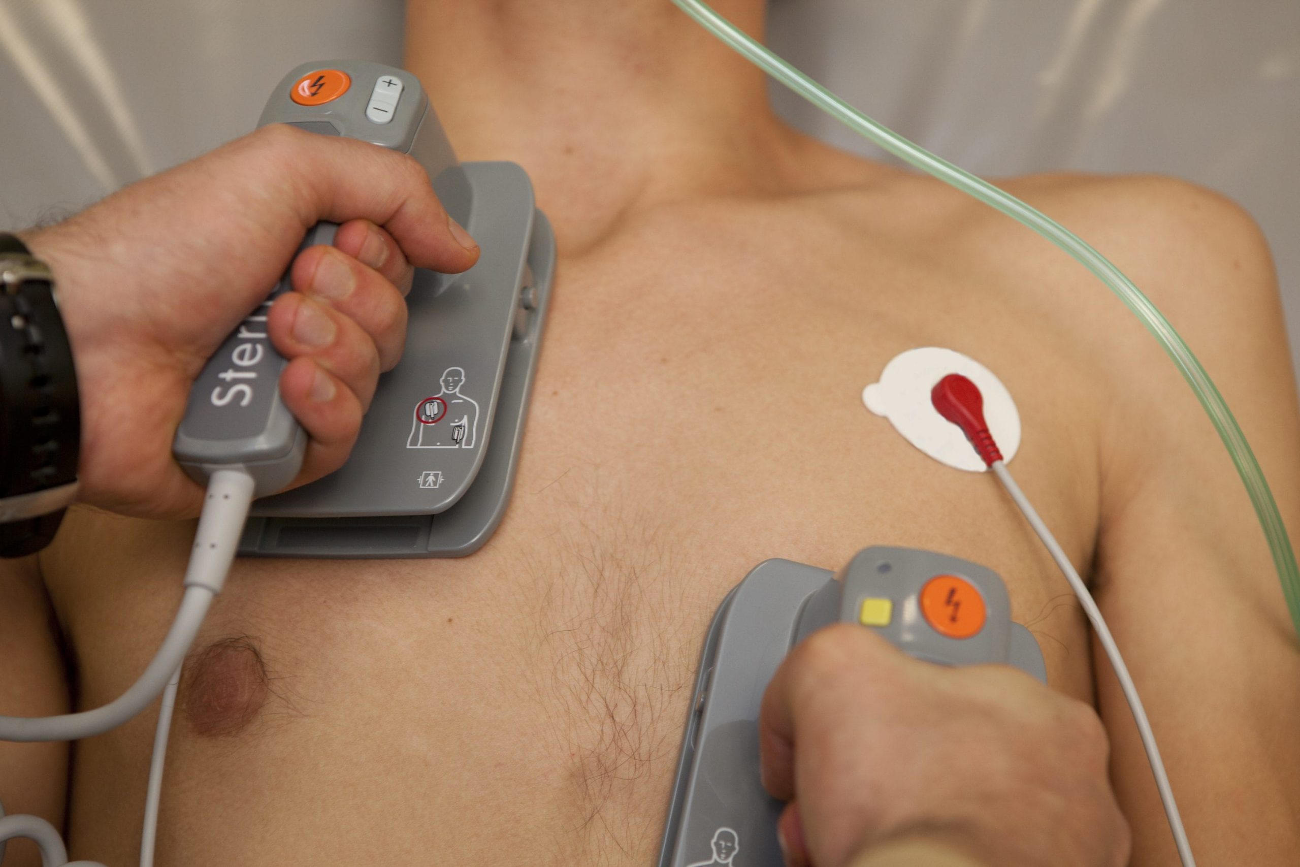 defibrillatore