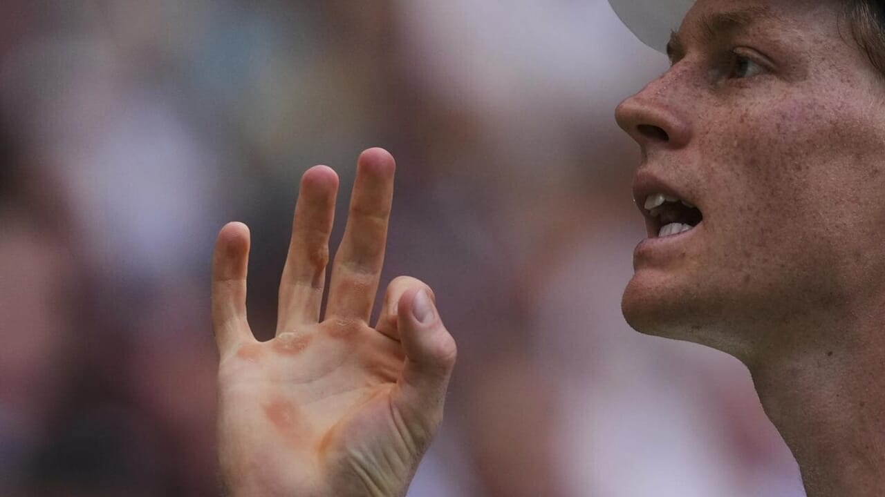 Le pécheur était malade et les organisateurs de Cincinnati sifflent les oreilles