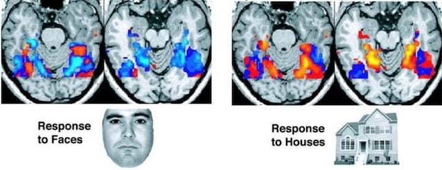 activation des zones du cerveau rêves