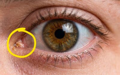 que sont les cips et comment ils se forment