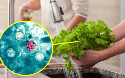 Cyclosporose aux USA, les infections en hausse : quelle est l&rsquo;infection provoquée par le parasite qui contamine les aliments