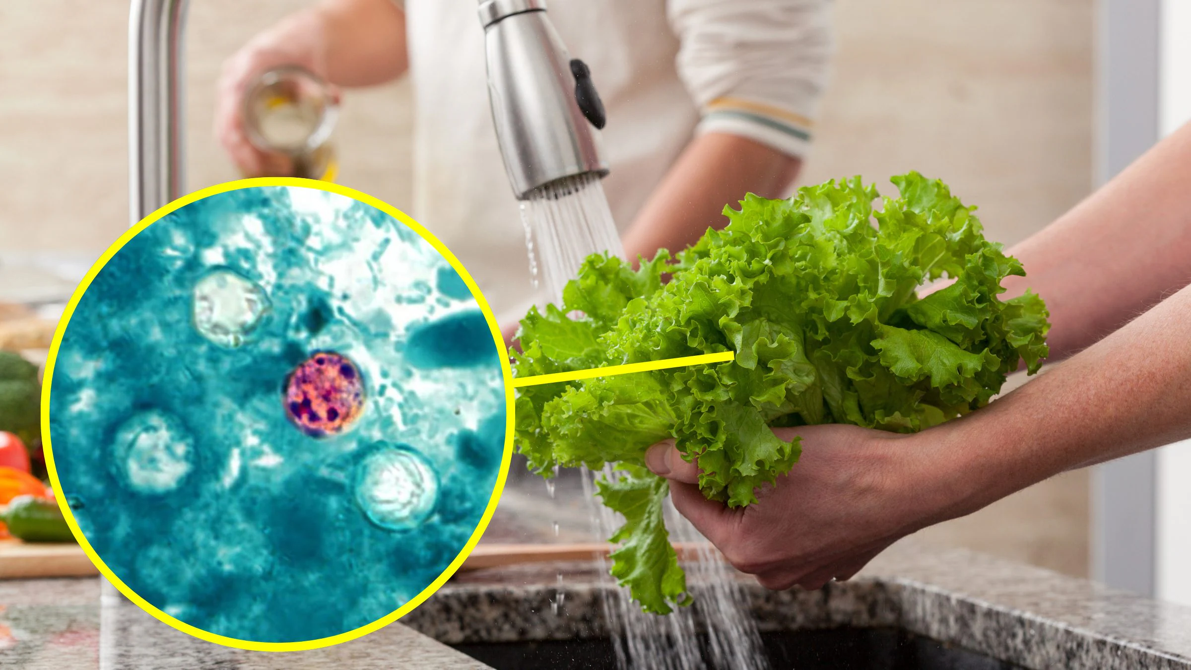 Cyclosporose aux USA, les infections en hausse : quelle est l'infection provoquée par le parasite qui contamine les aliments