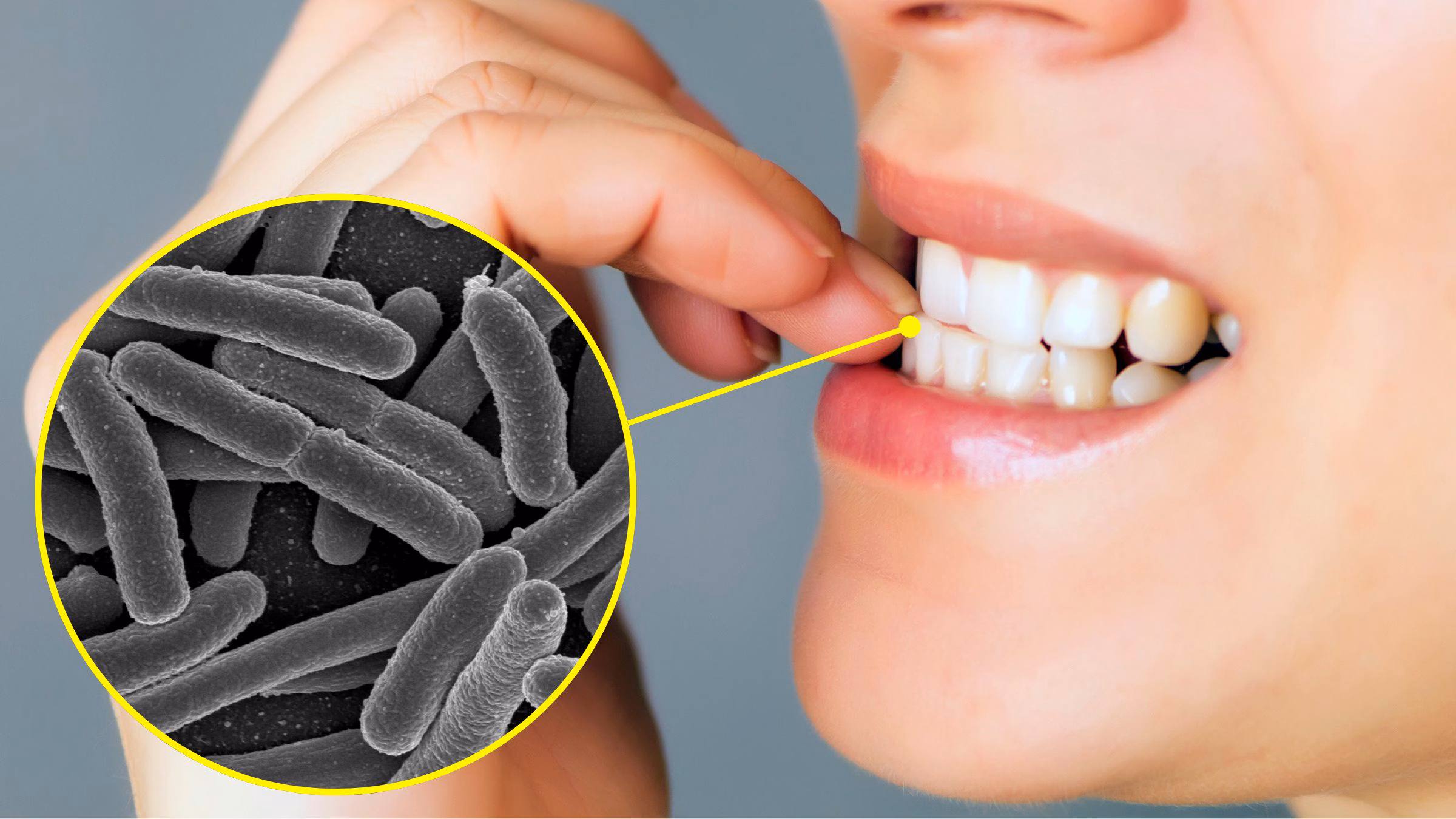Sous les ongles, il y a jusqu'à 100 fois plus de bactéries que dans le reste de la main : études microbiologiques