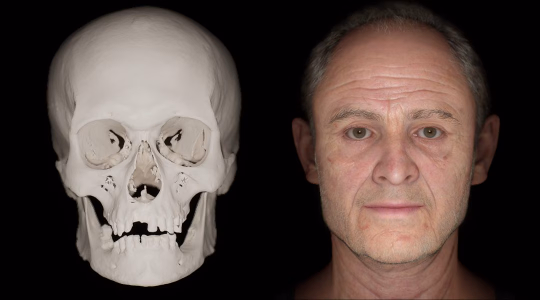 Le visage de l'Homme de la Conquête de l'Angleterre en 1066 révélé : était-il un Viking ou un Saxon ?