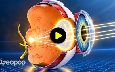 L&rsquo;opération la plus pratiquée au monde : nous vous montrons la cataracte en vidéo 3D