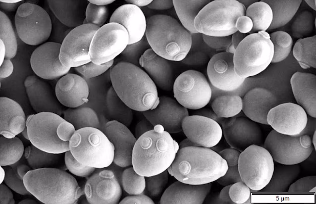 Saccharomyces_cerevisiae_SEM