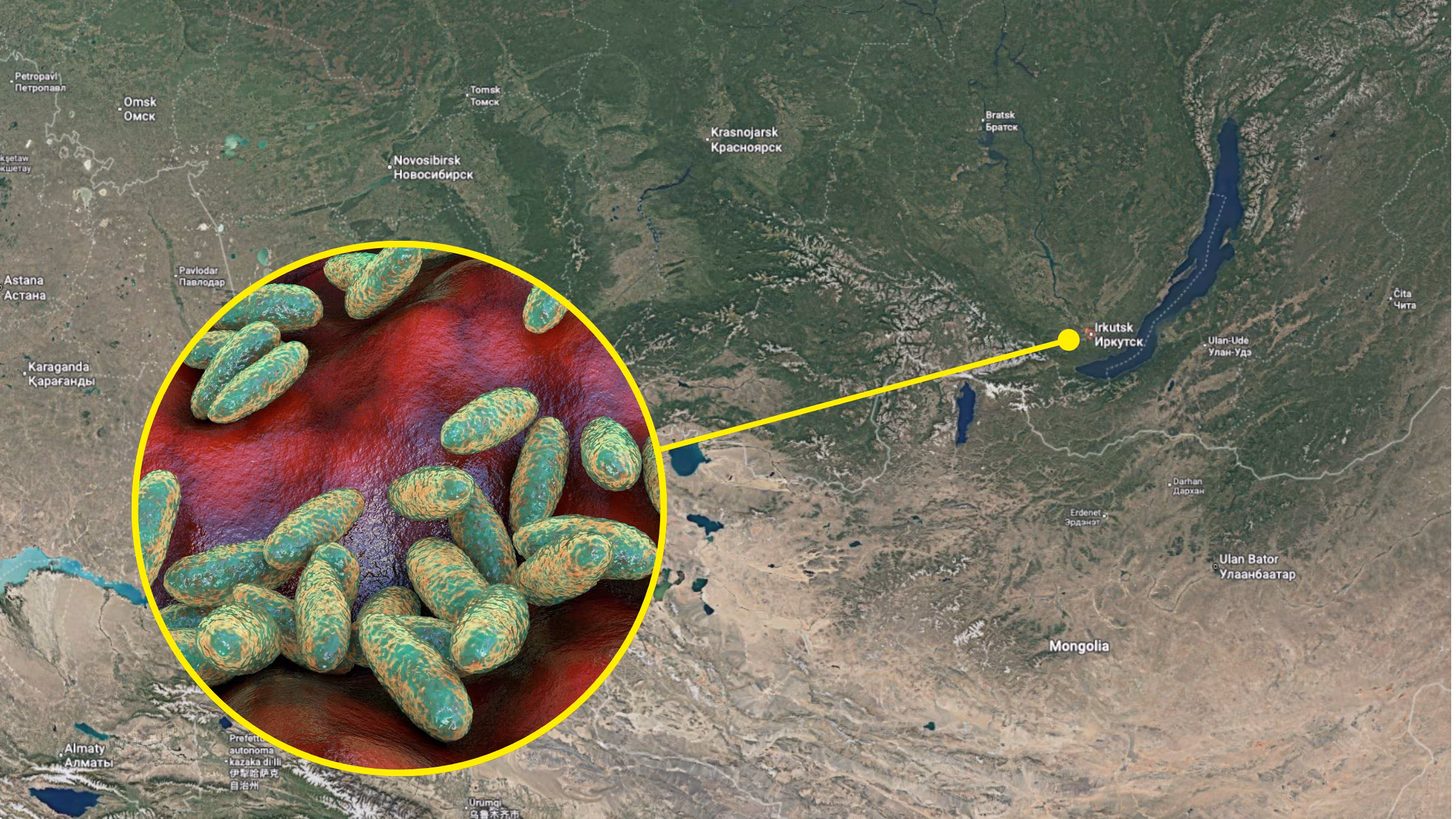 Ce que nous savons du cas présumé de peste pneumonique en Sibérie, où il se trouve dans le monde et comment l'infection se produit